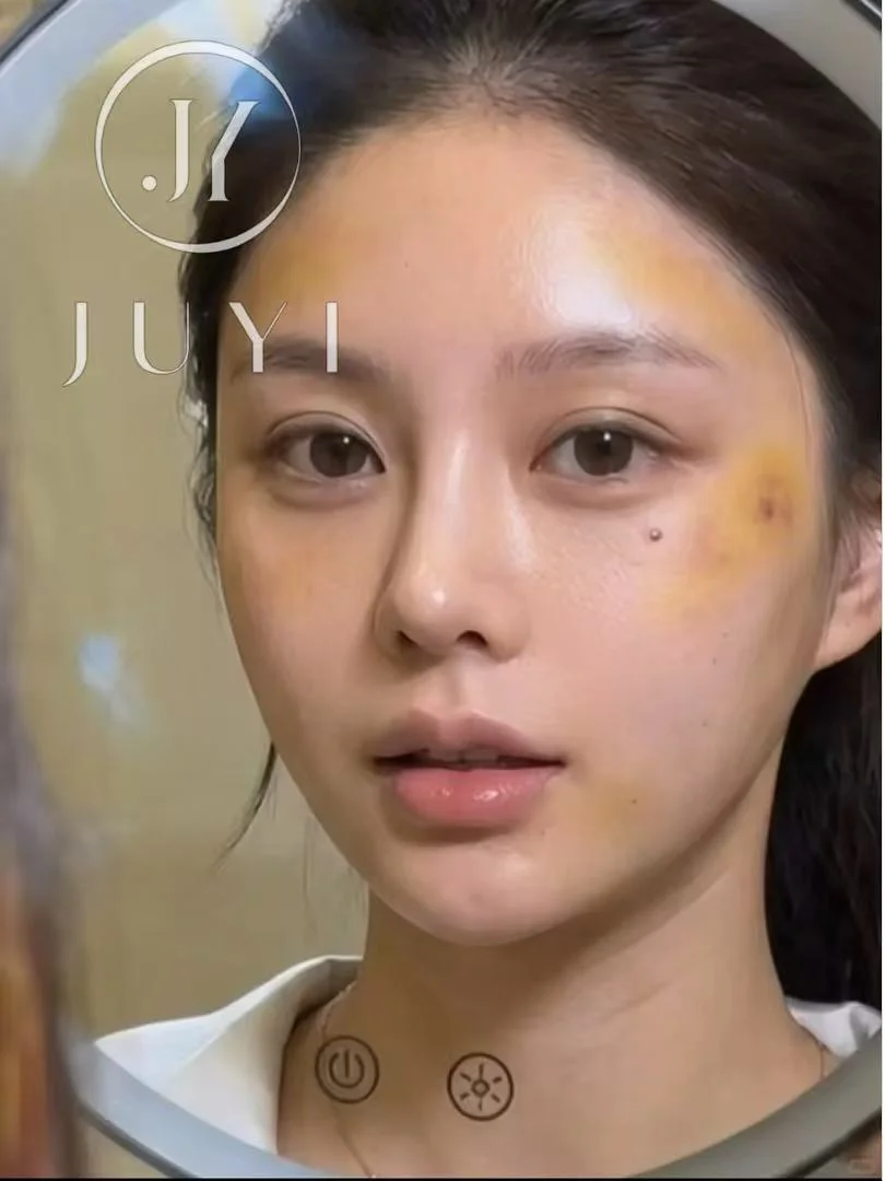 ARCrefinelift™ Facial Restoration Case 1