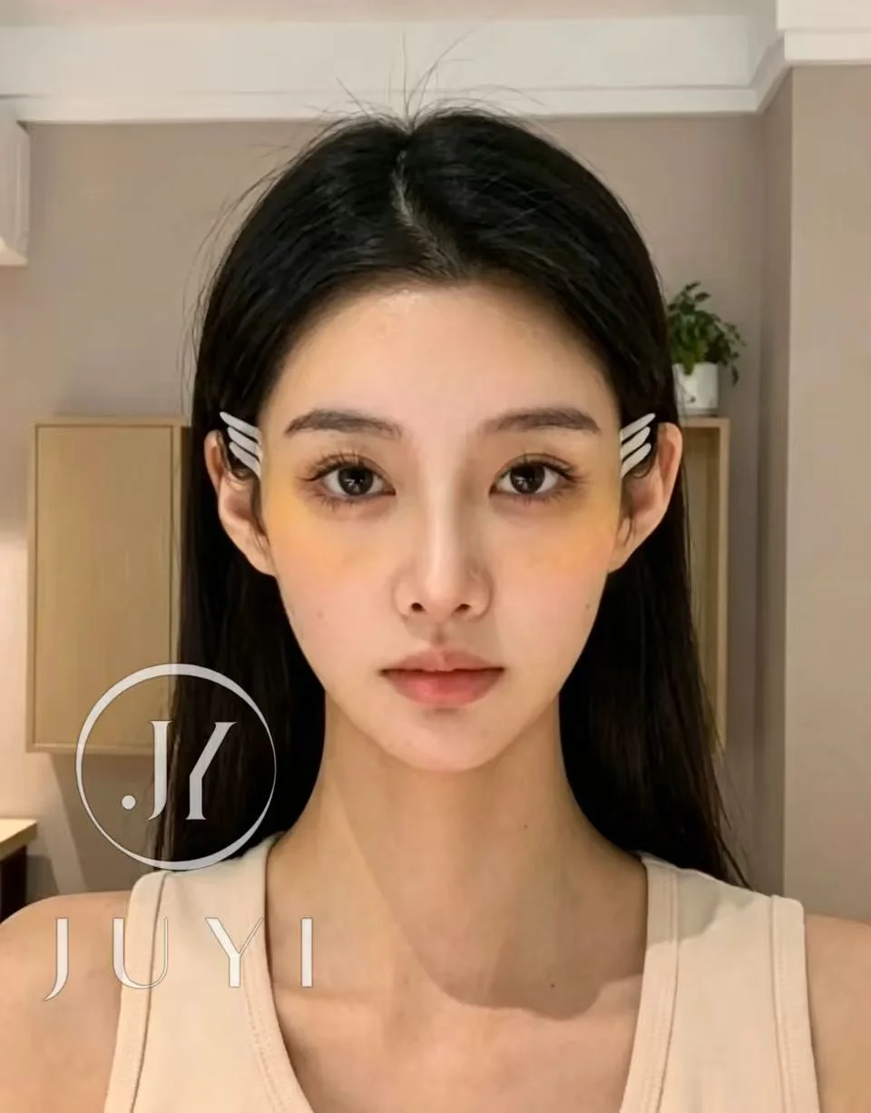 ARCrefinelift™ Facial Restoration Case 6