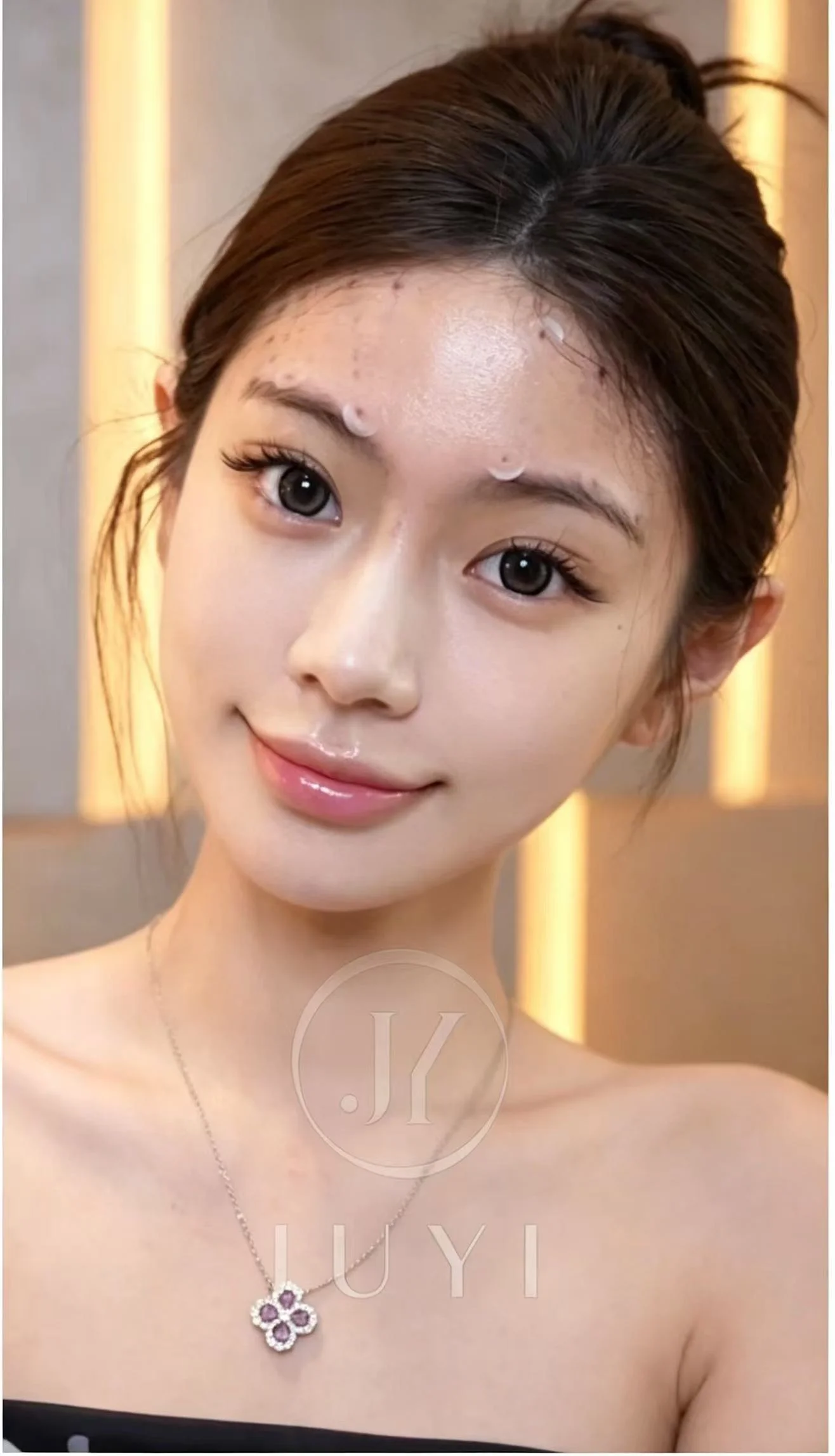 ARCrefinelift™ Facial Restoration Case 11