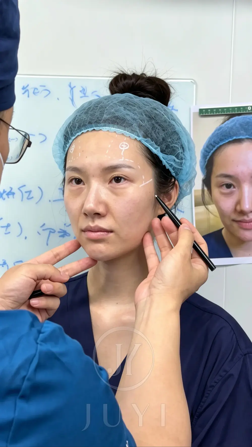 ARCrefinelift™ Facial Restoration Case 14